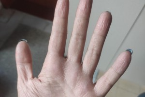 汗手是不是玩不了手游，汗手是什么原因